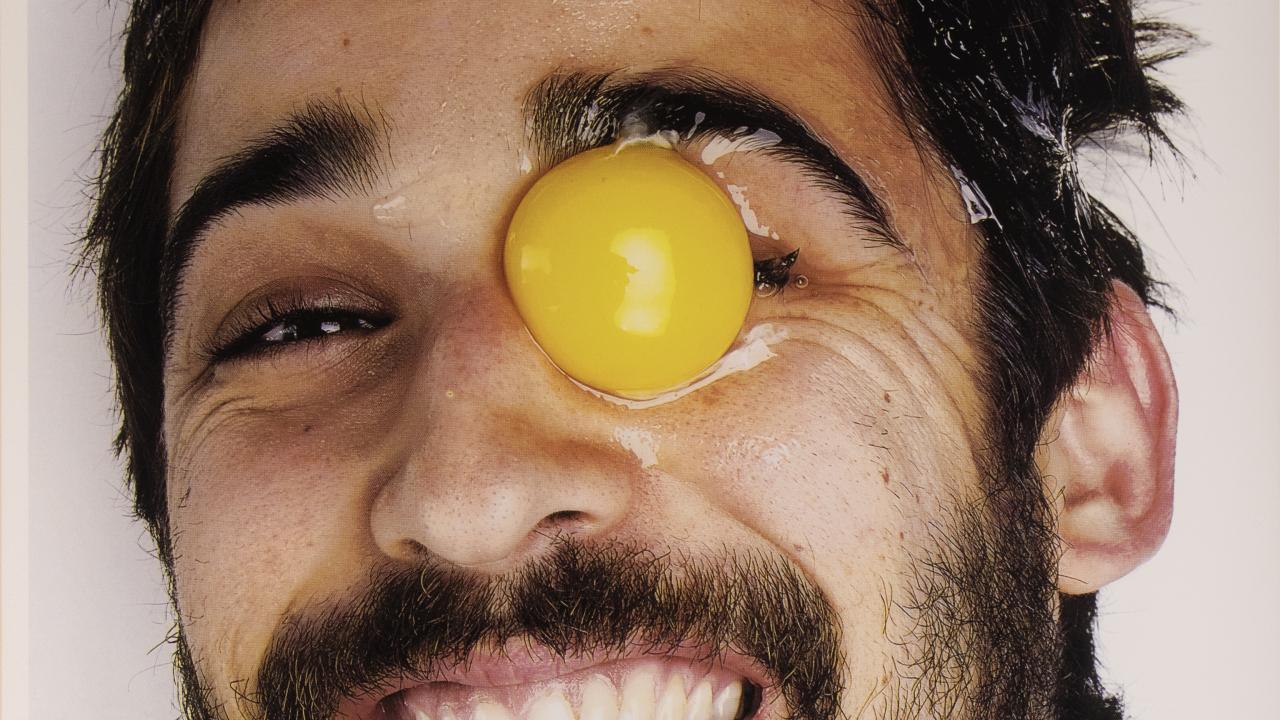 Photograph of smiling man with a raw egg in his eye socket.
